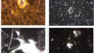 Lee más sobre el artículo Científicos alemanes encuentra tóxicos inusuales en todas las vacunas COVID analizadas