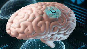 Lee más sobre el artículo Neuralink, el chip cerebral para humanos de Elon Musk